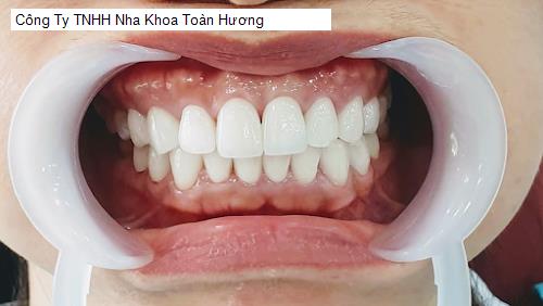 Công Ty TNHH Nha Khoa Toàn Hương